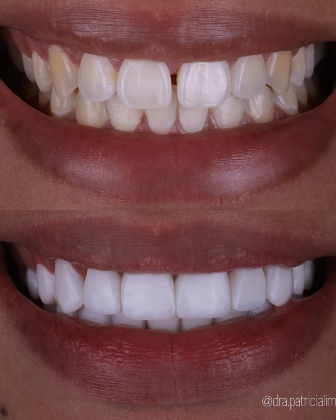 Antes e Depois 6